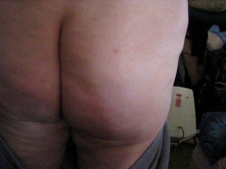 More Pics Of Exposed Obese Whale Fat Pig Susan Kirsch (804/1788)