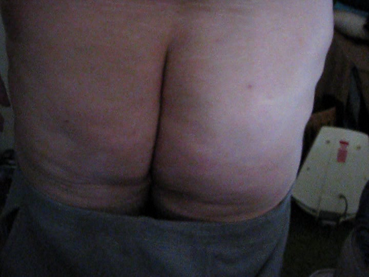 More Pics Of Exposed Obese Whale Fat Pig Susan Kirsch (810/1788)
